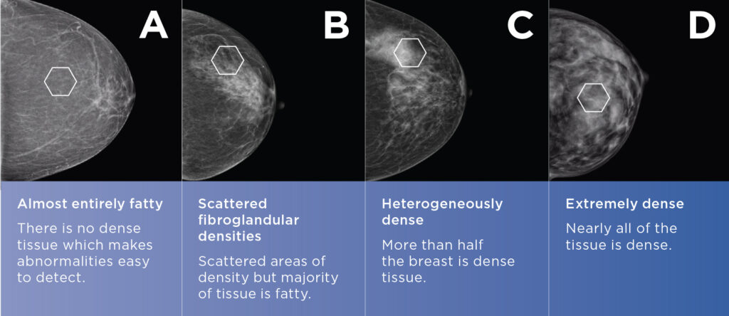 ADVANCES IN BREAST IMAGING - Mayfair Diagnostics