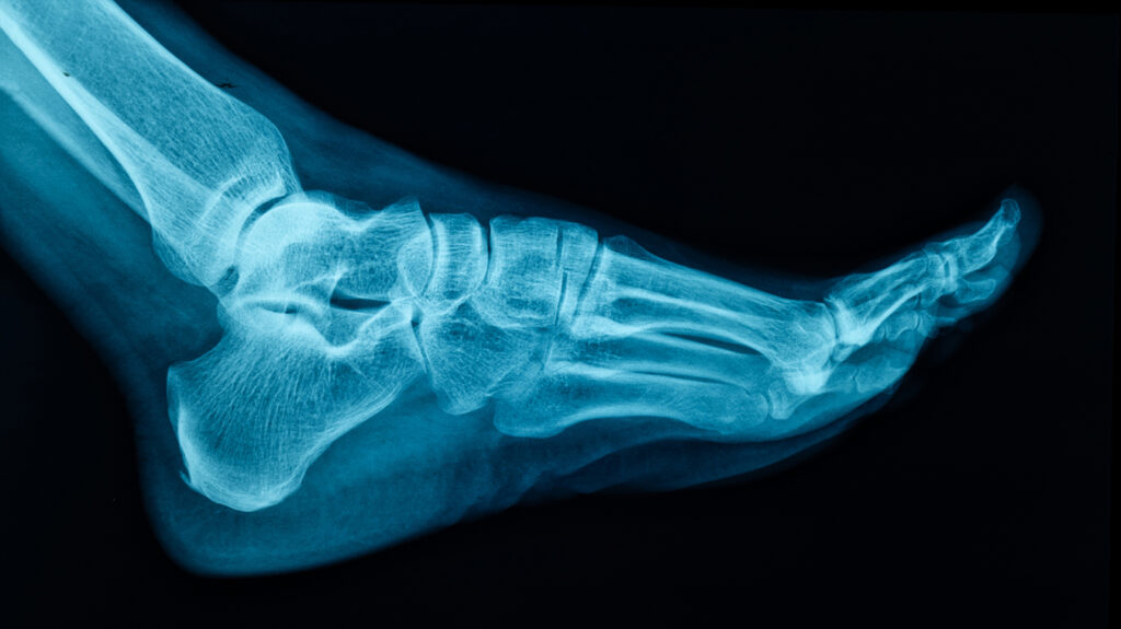 WHAT’S THE DIFFERENCE BETWEEN CT AND X-RAY? - Mayfair Diagnostics
